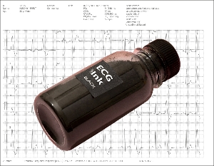 Troubleshooting Faint ECG Trace Prints