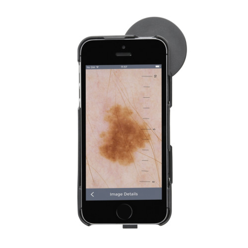 Heine iC1 Dermatoscope