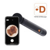 Heine DELTA 30 PRO Dermatoscope